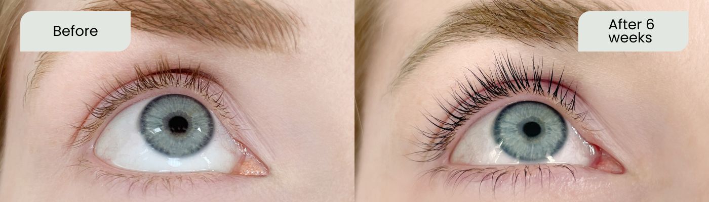 Lash Revive Before and After